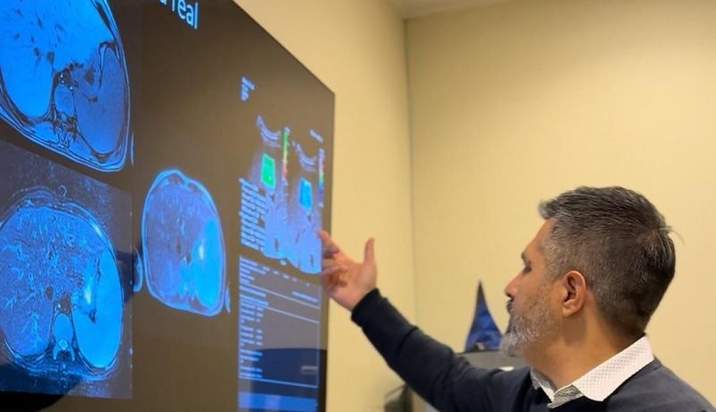hospital-puerto-montt-innova-con-elastografia-hepatica-avanzada