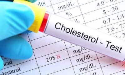 perfil-lipidico-como-interpretar-y-controlar-el-colesterol