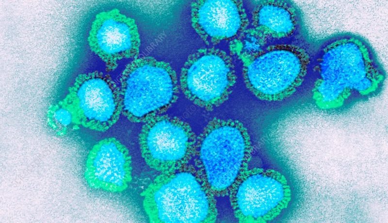 Confirman primer caso de Influenza A(H3N2) en Chile: Síntomas y cómo prevenir contagios