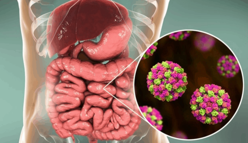 Alerta Sanitaria: Gastroenteritis Viral se Propaga en la Región Alerta Sanitaria: Gastroenteritis Viral se Propaga en la Región
